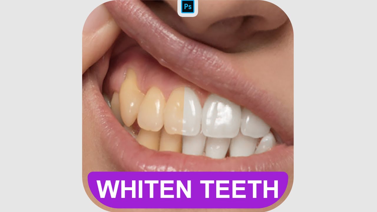 How To Whiten Teeth In Photoshop - Tutorial